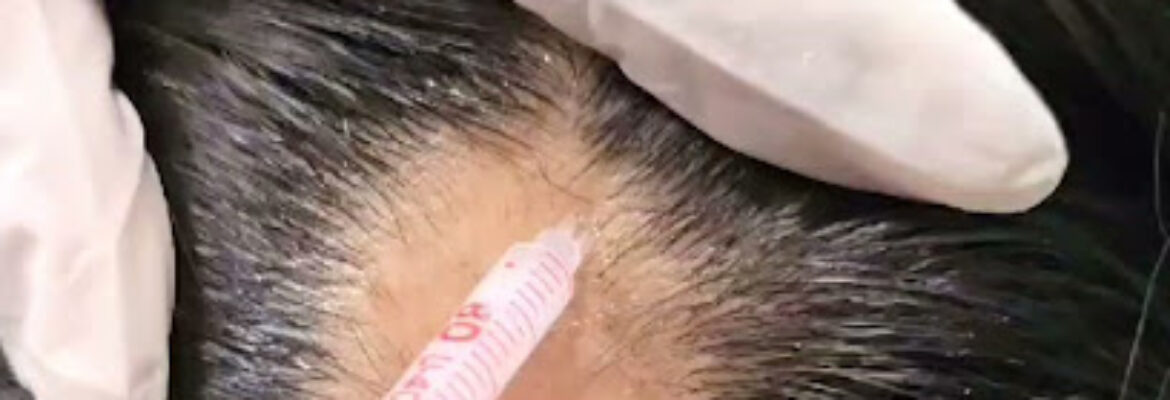 DR MEHER  LASER AESTHETICA COSMETIC CLINIC   SKIN SPECIALIST  HAIR LOSS TREATMENT  WEIGHT LOSS   PLASTIC SURGERIES